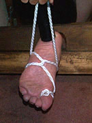 Bound foot